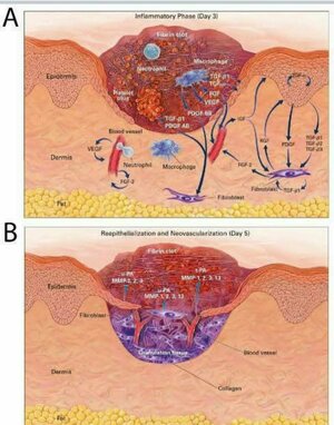 The Science of Wound Healing: A Physiotherapist Role in Recovery | Dr. Abhilipsa Priyadarshini